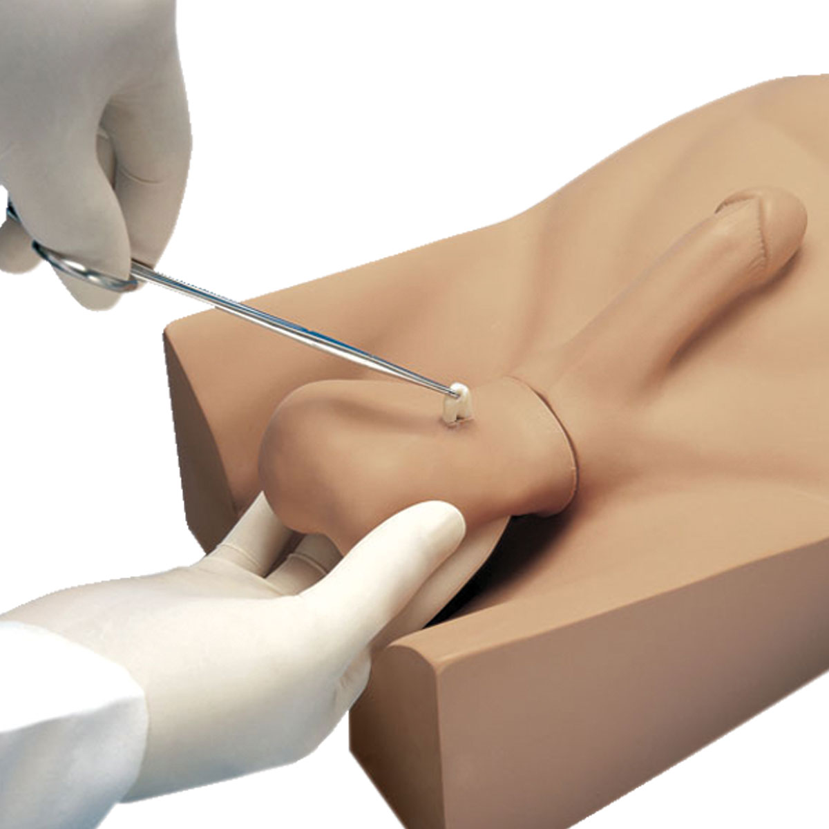 No-Scalpel Vasectomy Clinic  Virtually Painless & Fast Recovery